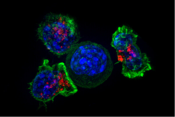 Do our bodies coddle cancer cells? The image shows Killer T cells surrounding a cancer cell.